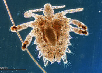 สิ่งซ่อนเร้นบน…จุดซ่อนเร้น